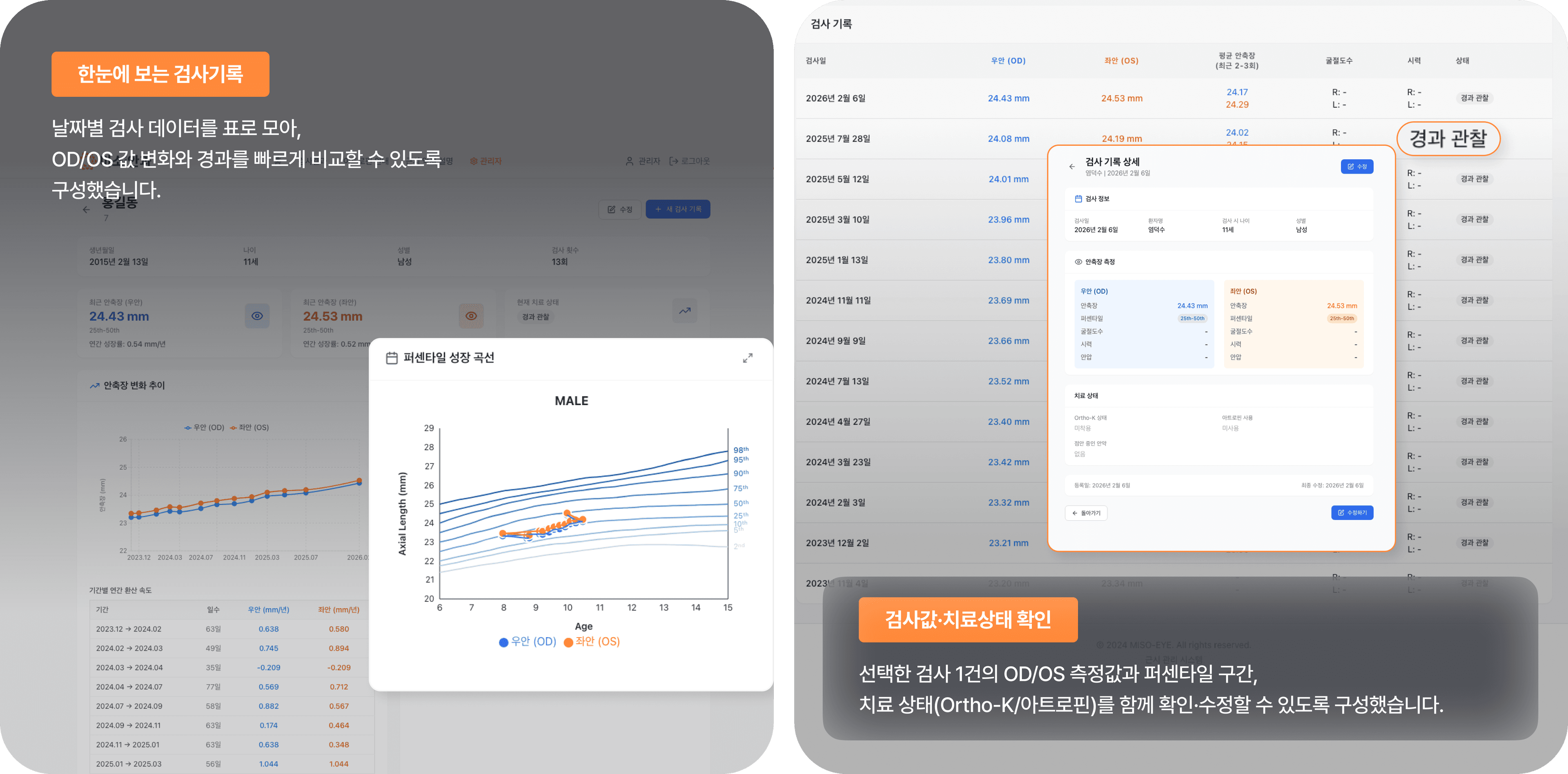 환자 상세 기록과 근시 진행을 한눈에